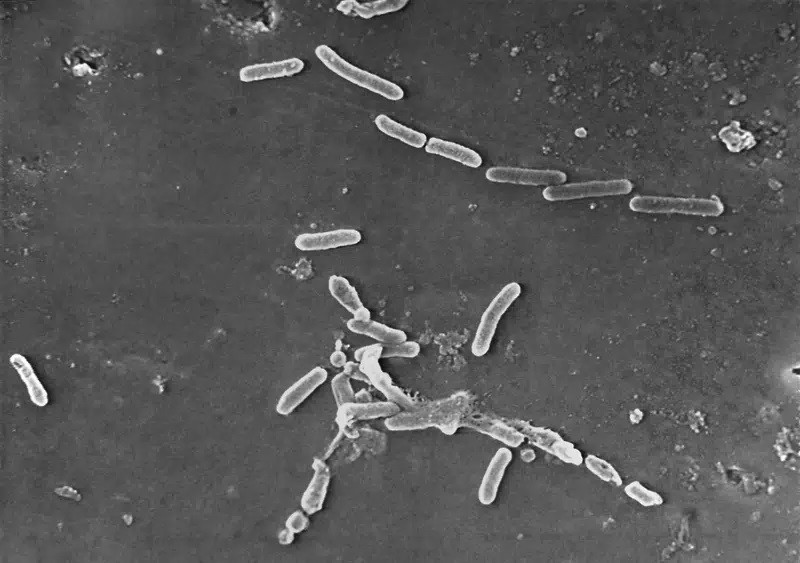 H&igrave;nh ảnh k&iacute;nh hiển vi điện tử của vi khuẩn Pseudomonas aeruginosa h&igrave;nh que. Ảnh: CDC Mỹ